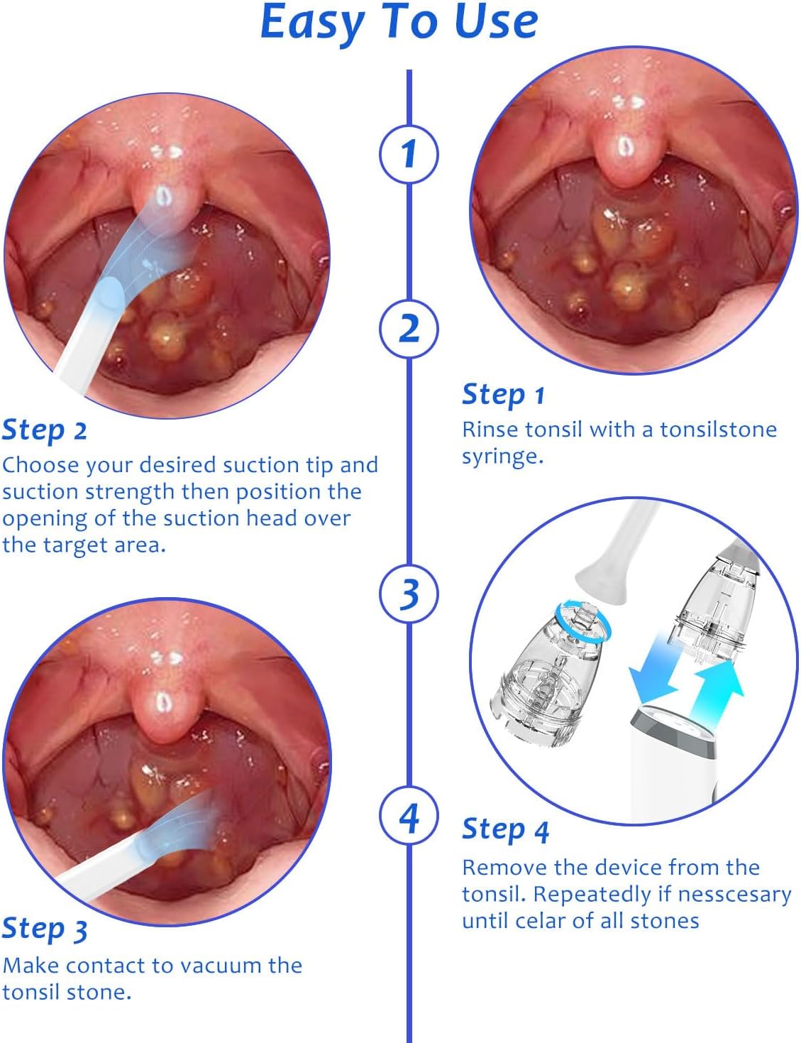 8 Suction Modes 3 Levels Tonsi - đánh giá và giá Electronics Repair And Maintenance